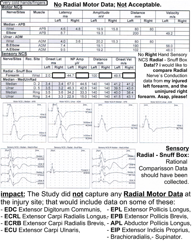 Missing Radial Nerve Conduction Study (NCS) Data